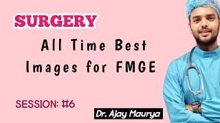 Surgery most Important Images For FMGE