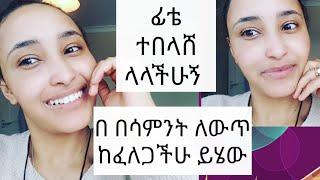 የፊቴ ሚስጥር ይሄው ሞክሩት  በሳምንት ለውጡን ታዩታላችሁ