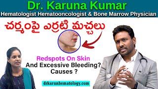 Redspots On Skin | Excessive Bleeding Causes and Treatment |    Dr Karuna Kumar | Hematologist