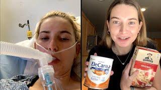 Woman Allergic to Everything Except 2 Foods