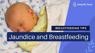 Breastfeeding Tips: Jaundice and Breastfeeding
