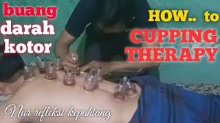 HOW TO DO CUPPING THERAPY - Nur refleksi