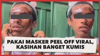 Video Lelaki Pakai Masker Peel Off Viral, Kasihan Banget Kumis Kiri Kanannya Habis Tertarik