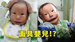 23歲產婦生下嬰兒，孩子面部斷裂像帶面具，醫生：都是媽媽惹得禍！ |生寶寶|懷孕|明星觀察員