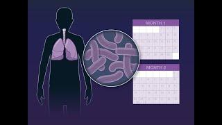 Shorter Course for Tuberculosis Treatment | NEJM