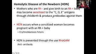 Hemolytic Disease of the Newborn HDN