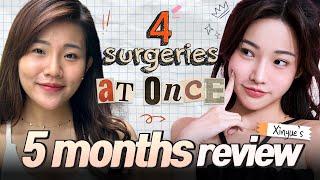 Having 4 surgeries at ONCE!  | Xinyue's PLASTIC SURGERY journey at BRAUN (Part 2)