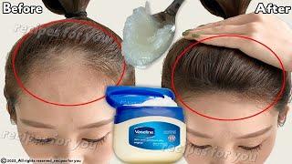 How to use Vaseline for double hair growth, your hair will grow 3 times faster