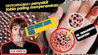 NGERI TUBUH BOLONG BOLONG !! BIKIN GELI !!MENGENAL TRYPOPHOBIA