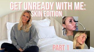 GET UNREADY WITH ME - SKIN EDITION PART 1