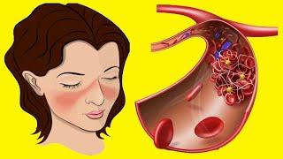 Thick Blood: Causes And Symptoms