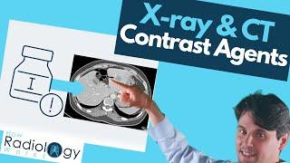 Contrast Agents in X-ray and CT Scans: What You Need to Know