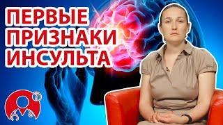 Каковы первые признаки инсульта? | Вопрос Доктору