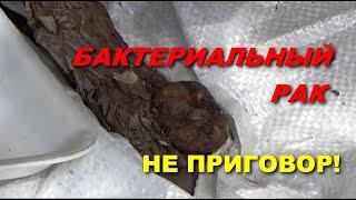 ПОБЕДИТЬ БАКТЕРИАЛЬНЫЙ РАК МОЖНО