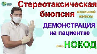 Стереотаксическая биопсия молочной железы |ДЕМОНСТРАЦИЯ|