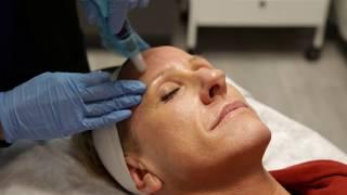 Vampire Facial® | RejuvenationMD