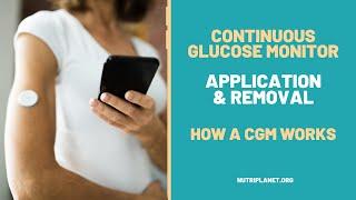 Continuous Glucose Monitor Unpacking & Application | How the CGM works