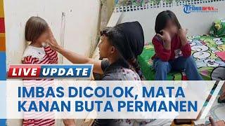 Imbas Dicolok Tusuk Bakso, Siswi SD Kehilangan Pengelihatan & kini Dapat Pendampingan Psikologis