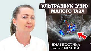 УЗИ малого таза: что можно увидеть и зачем это нужно?