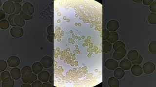 White Blood Cells fighting under microscope!