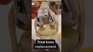 When you need total knee replacement? #shorts