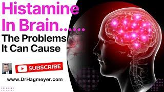 Is Excess Brain Histamine The Cause of Your Symptoms? Histamine causes brain fog