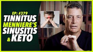 Ep:379 TINNITUS, MENNIERE’S, SINUSITIS AND KETO