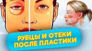 Рубцы и отеки после пластики: кому их избежать легче?