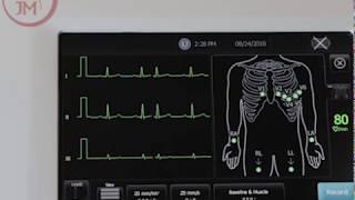 How to Use the Welch Allyn CP150 EKG Machine and Product Features