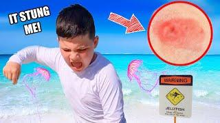 HE got Stung at the BEACH by JELLYFISH!!