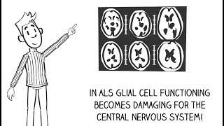 ALS and glial cells