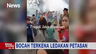 Bocah Terluka Parah Terkena Ledakan Petasan