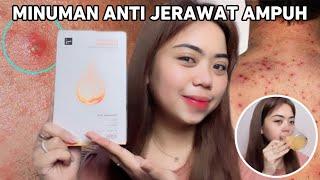 MINUMAN ANTI JERAWAT AMPUH