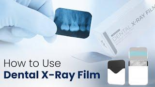 How to use Dental X-Ray Film | Waldent Dental X-Ray Film IOPA