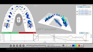 T-Scan/DTR theory & interpretation