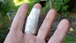 Well Helcope you Broke your Finger