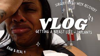 Vlog: Getting A Breast Lift + Implants| Very Raw & Real Recovery,Surgery Day- 1 Week Post Op