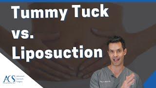 Liposuction and Tummy Tuck Surgery: Differences, Cost, Recovery & Results