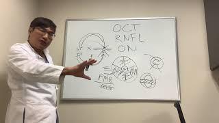 Understanding Optic Nerve OCT