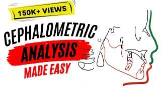 Cephalometric analysis