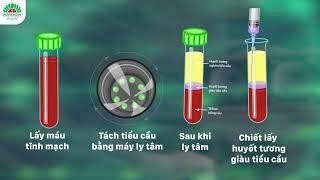 Tiêm huyết tương giàu tiểu cầu - Giúp điều trị thoái hóa khớp gối từ giai đoạn 1-4