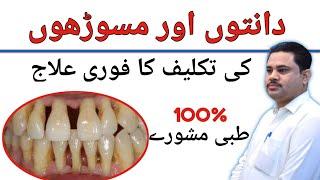 Pyorrhea ka gharelu ilaj | pyorrhea treatment at home | Periodontitis Treatment | pyorrhea symptoms