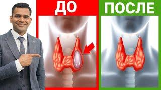 Как Уменьшить Узлы Щитовидной Железы Естественным Путем | Доктор Вивек Джоши