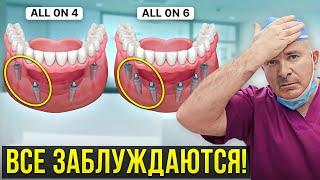Вся правда об имплантации ВСЕ-НА-4 и ВСЕ-НА-6! Об этом молчат все стоматологи…