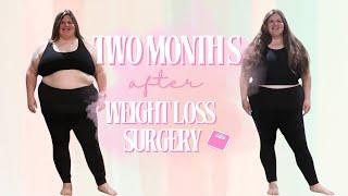 2 Months After Weight Loss Surgery  | Weight Loss Progress update