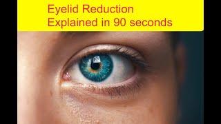 Eye lid reduction in 90 seconds