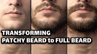 My 5 HABITS for transforming PATCHY BEARD to FULL BEARD in 30 days