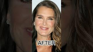 BROOKE SHIELDS BEFORE AFTER 2023 SHORTS