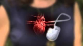 Defibrillator-Pacemaker: What's the Difference?