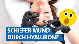 Hyaluron spritzen „to go“ – darum kann das gefährlich werden  | WDR Markt